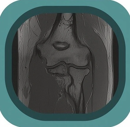 mri elbow anatomy icon
